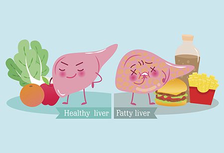 how to reduce fatty liver